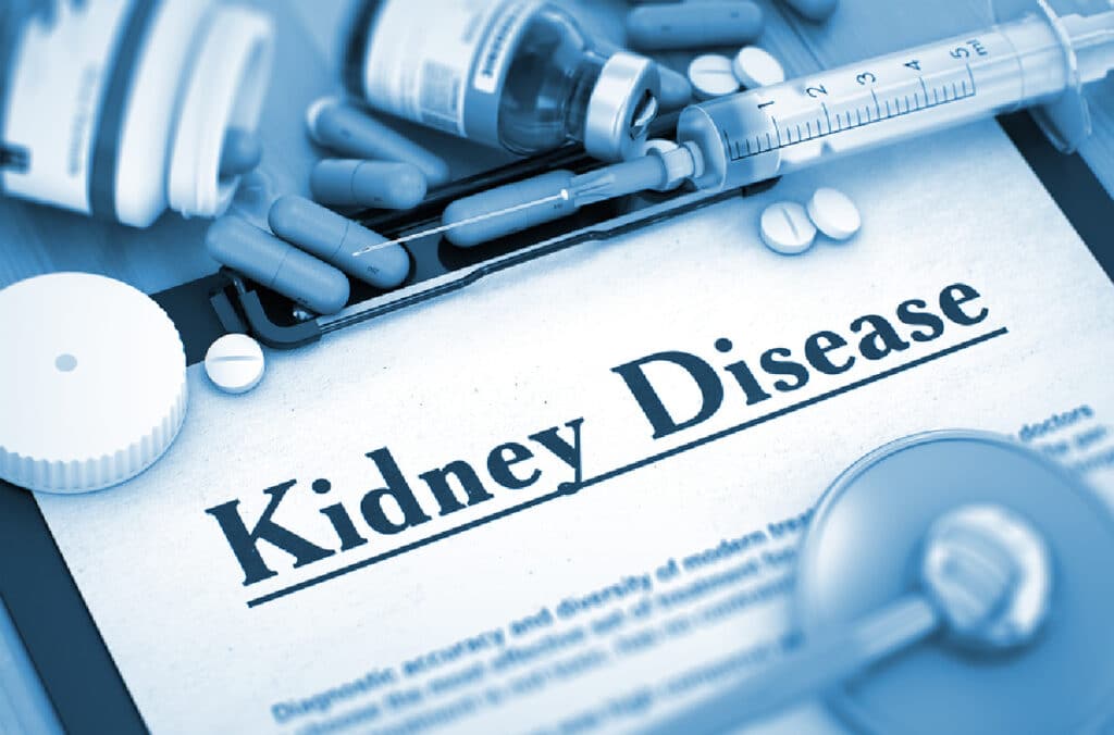 Senior Home Care in Manhattan Beach CA: Kidney Disease