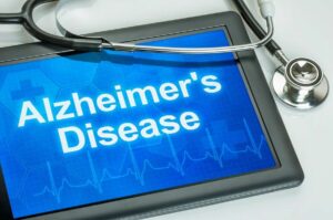 Alzheimer's Home Care Del Mar CA - Navigating the Stages of Alzheimer's Disease