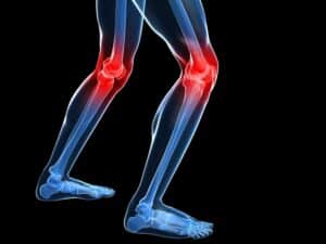 Home Care Assistance Del Mar CA - Tips for Healthy Knees